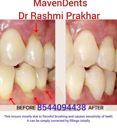 Mavendents Dental clinic, shapoorji